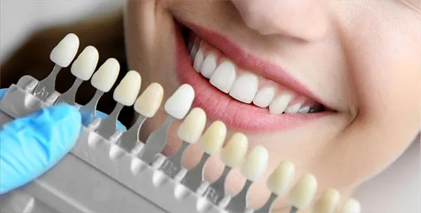 Millor enblanquiment dental de clinica a Blanes a Girona Millor enblanquiment dental de clinica a Blanes a Girona