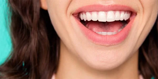 Taques a les dents enblanquiment dental a Blanes Girona Taques a les dents enblanquiment dental a Blanes Girona