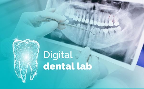 Empelt de geniva laboratori dental a blanes