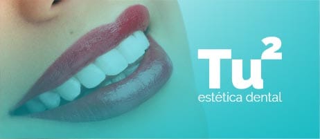 Clínica estética dental en blanes, girona