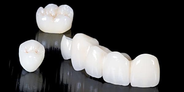 Coronas dentales de zirconio en blanes girona