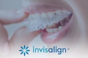 invisalign en blanes girona