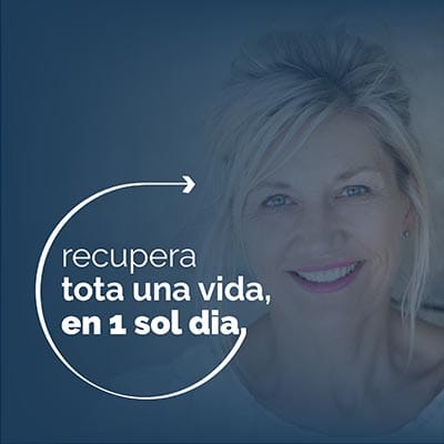 Recuperar toda la boca con implantes