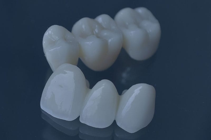 Corona dental zirconio blanes