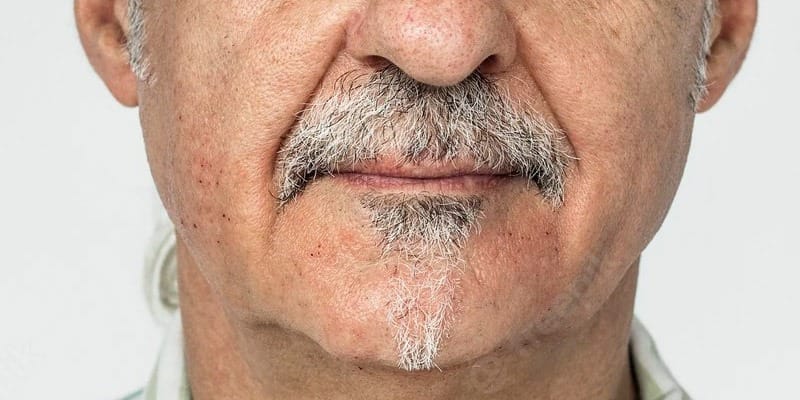 cuanto-tiempo-dura-implante-dental Cuanto tiempo dura un implante dental