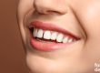espacios-entre-dientes-carillas-dentales