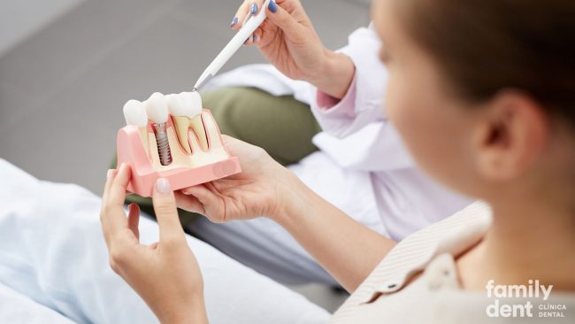 implantes-dentales-poco-hueso-girona-blanes implantes-dentales-poco-hueso-girona-blanes