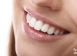 Tratamiento sonrisa gingival