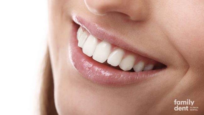 FAMILY – Tratamiento sonrisa gingival Tratamiento sonrisa gingival
