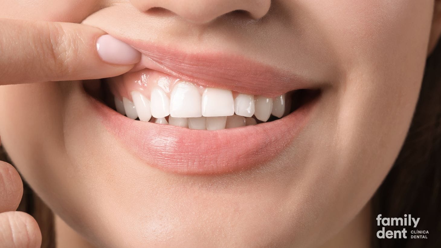 FAMILY – Periodontograma