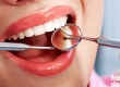Tratamiento de las Fracturas Dentales