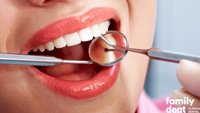 Tratamiento de las Fracturas Dentales